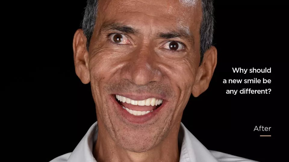 AnyConv.com__SMO_After_Photo_EN