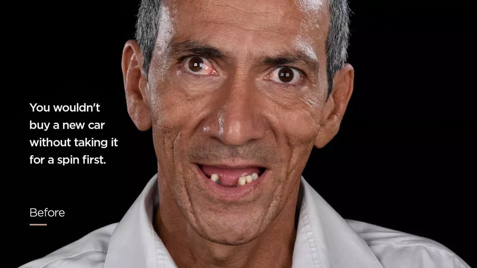 AnyConv.com__SMO_Before_Photo_EN