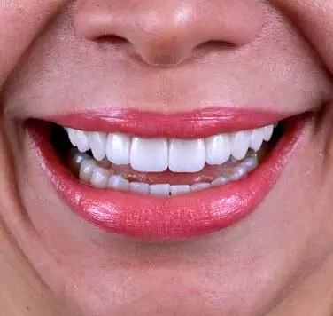 AnyConv.com__SMO_Main_Page_Gallery02