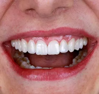 AnyConv.com__SMO_Main_Page_Gallery04